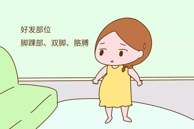 天天聊健康：孕期水肿恐影响胎儿发育！如何分辨孕期是“胖”还是“肿”？