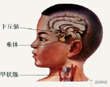 垂体病变的MRI诊断