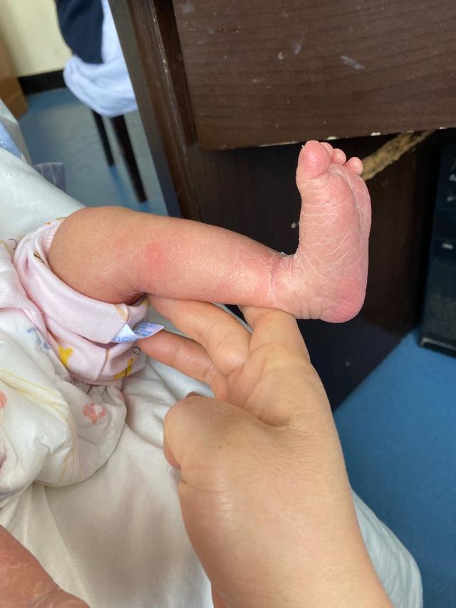 「你的育儿经」不要轻易给新生儿拍片子，警惕未来可能潜在的致命杀手
