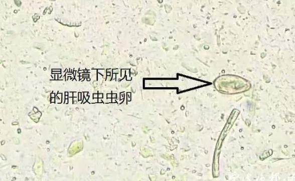 这种鱼片别吃！这里已发现4例