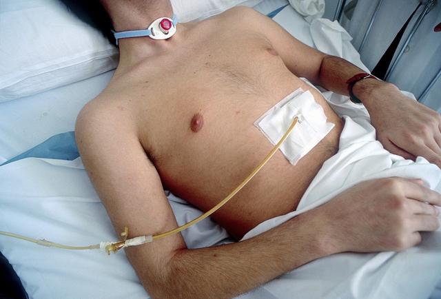 癌症总是悄悄来到，医生忠告，5种胃病会癌变，越早诊治越好