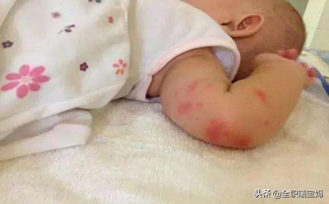 相亲相爱|宝宝总被蚊子叮?防蚊、止痒的正确方法,这样做!