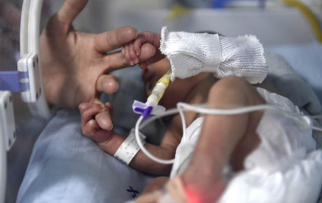 新生儿|“长颈鹿医院”刮头脑风暴，找患儿就医的痛点难点！|我为群众办实事①