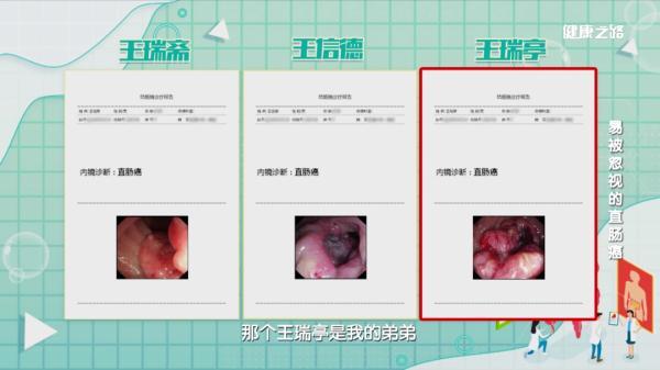 直肠癌|直肠癌的防治，专家为您支招