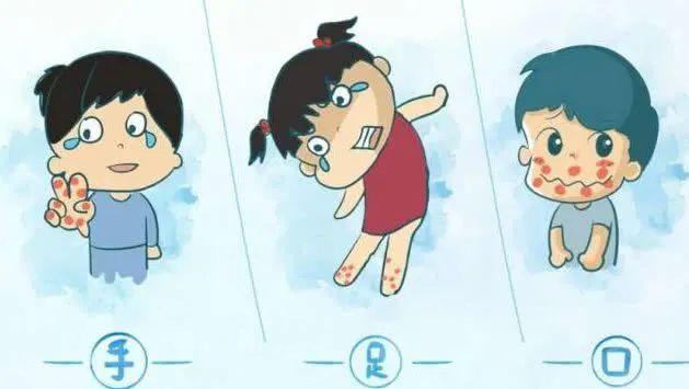超级宝妈|夏季，如何应对手足口病？