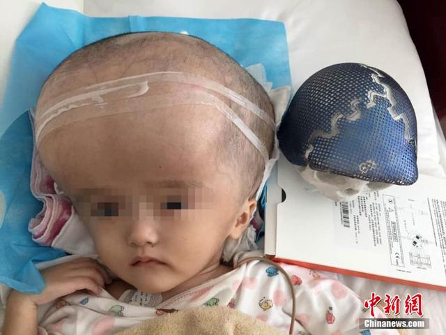 你的育儿经■饮料当奶粉喝成大头娃娃，关于婴幼儿喂养，宝妈必须知道的知识点