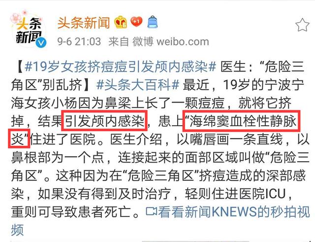 痘痘|警惕！挤了颗痘痘，瘫痪了