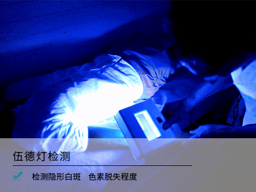 白癜风|正式通知！国家重点实验室在辽宁省招募100名白癜风患者，点击查看报名