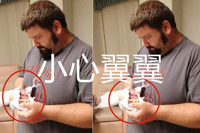 #天使宝贝#世界最小婴儿怎样了,出生时仅有苹果大小,现状令很多人“满意”