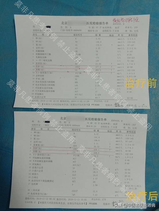 早年错过肾病最佳治疗期，如今病情又复发，45岁的刘女士该如何