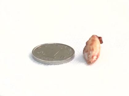 环球网|3岁娃被鸡抓了一下，伤口竟“长出”鸡趾甲！父母急坏了…