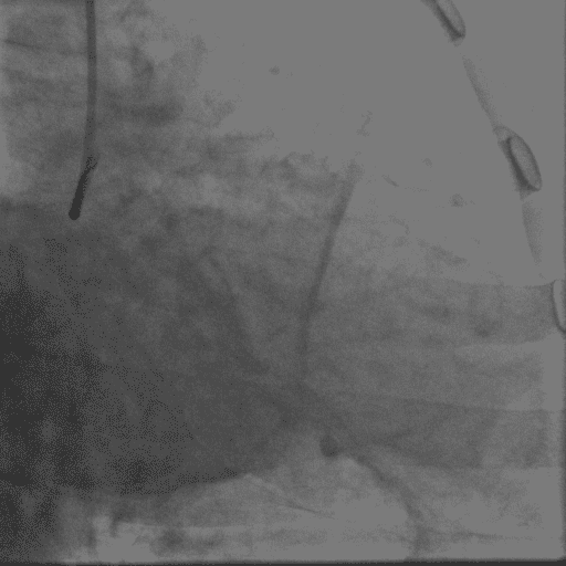 心电图|得了心脏病哪些检查最准确？这份“心脏检查指南”请收好！