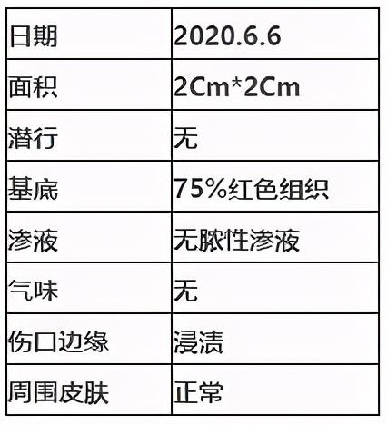 创伤灵粉在糖尿病足中的应用