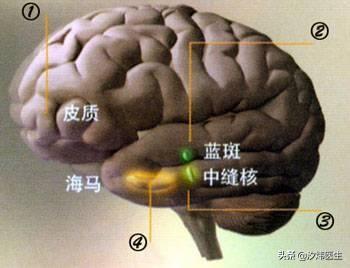 去甲肾上腺素|怕光、怕声、身体疼痛！精神科医生为你讲述“不一样的抑郁”