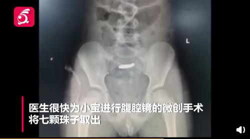 你的育儿经|再现夺命儿童玩具，还不当回事？
