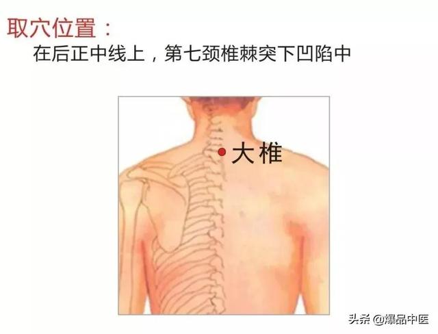 18个艾灸特效穴，一般人不知道