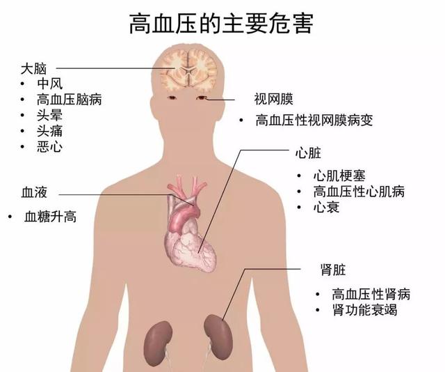 为什么有的人血压高得离谱却“没有事”？那是不是就不用吃药了？