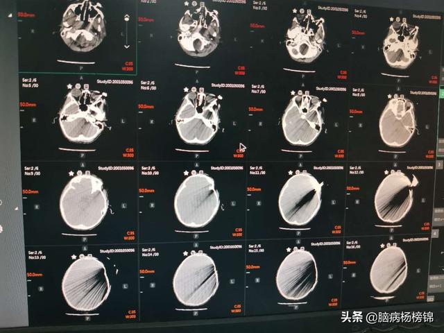 你的育儿经▲熊孩嬉闹 剪刀入脑 上篇飞刀 这个更孬