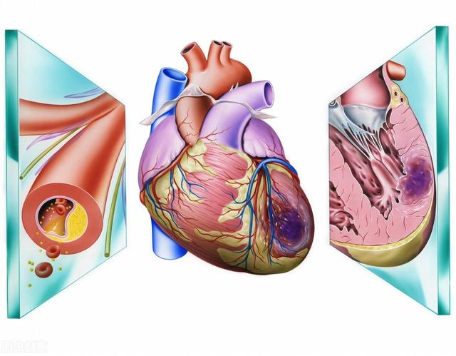 为什么心脏支架或心脏搭桥术后缩短人的寿命？医生辟谣讲清楚