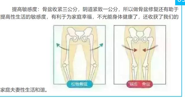 动辄上万的产后骨盆修复：把女性物化到极致的“圈套”