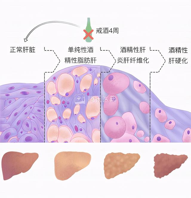 酒精进入体内后，吃什么“解药”能快速醒酒？答案终于明确了！