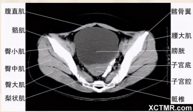 影像解剖：胸、腹部、盆腔CT解剖