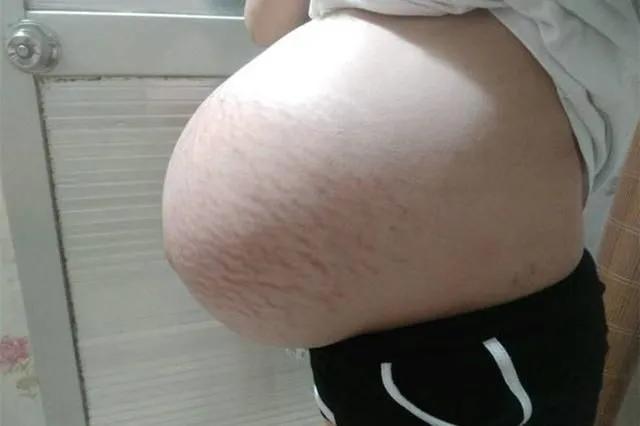 超级宝妈：“悬浮肚”爆红网络，孕妈痛苦有谁知！网友：双胞胎？哪吒转世？