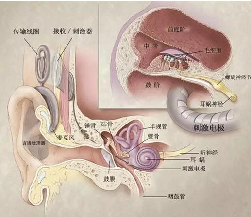 你的育儿经:关于儿童人工耳蜗的这些事儿