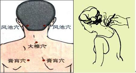 头晕、恶心、疼痛，可能是因为这些无意识的动作？