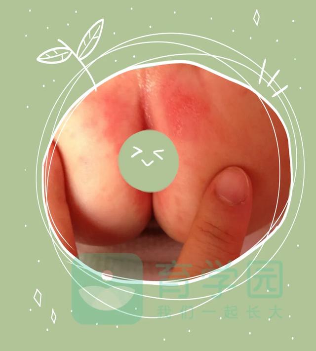 【超级宝妈】宝宝为什么会红屁股？做到这1点就能避免，但90%的家长却不知道
