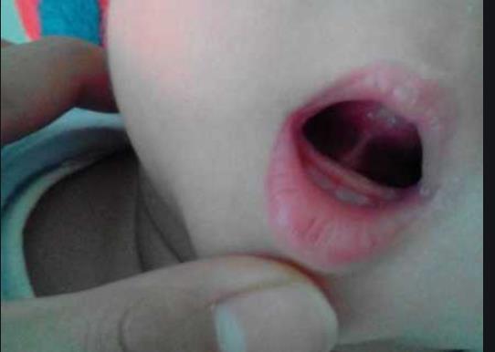超级宝妈|婚后6年终于怀孕，孩子刚出生就长三颗牙，医生看完竟吓了一跳