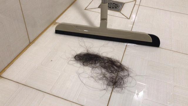 #你的育儿经#聊一聊产后脱发