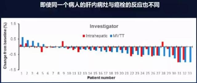 肝癌怎么治疗？转化治疗是否可靠？