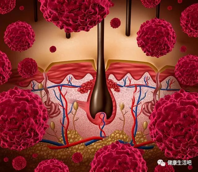 体内有癌脖子先知？脖子上出现这4个迹象，或许是癌症发出的信号