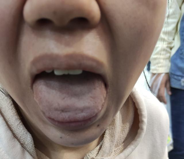 [你的育儿经]你的脾胃健康吗？