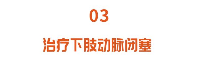 血管清道夫，斑块的克星！用它泡水喝，消斑块，预防心脑血管疾病