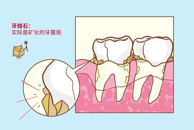 电动牙刷真的比普通牙刷好吗？看完这篇你就清楚了