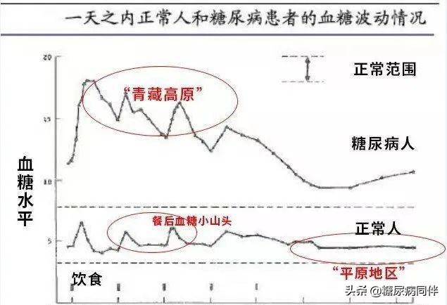 有人经常餐前饥饿难忍，或是糖尿病的征兆