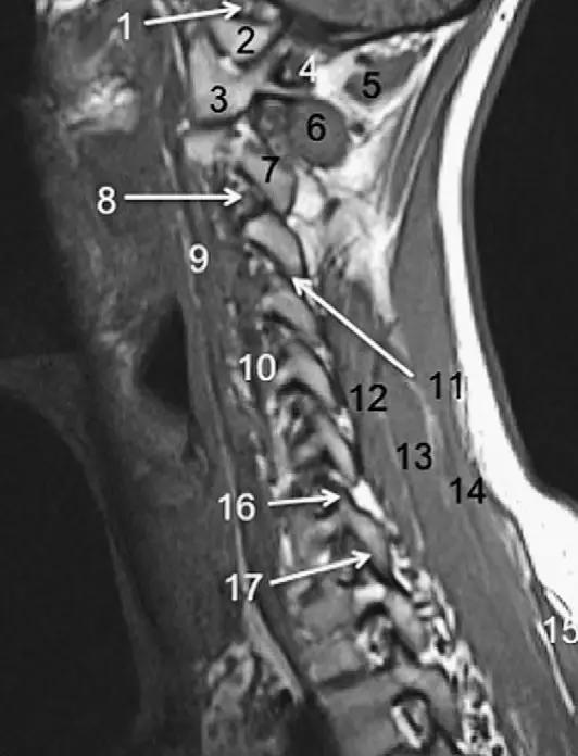 ռ׵ MRI ͼ