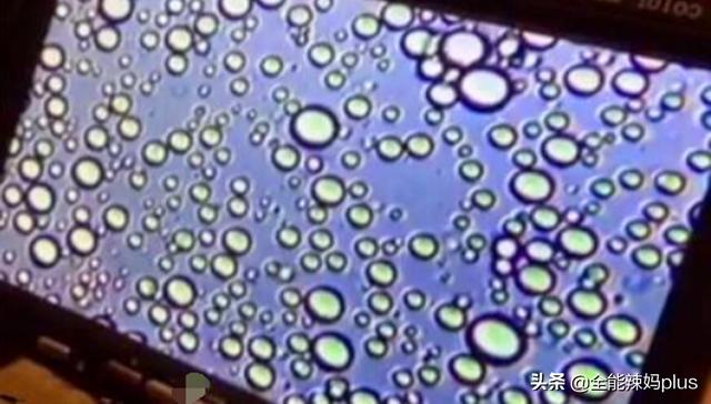 『超级宝妈』1000倍下的母乳什么样？显微镜下会动，网友：母爱最伟大！