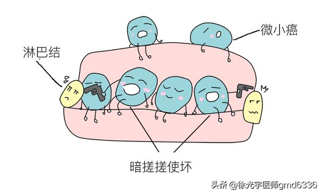 小于1厘米的微小癌，可以观察不手术？看看专家是怎么建议的