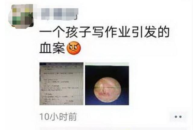 孩子不写作业被爸爸“扇耳光”，当晚儿子进了医院，怒气下别动手