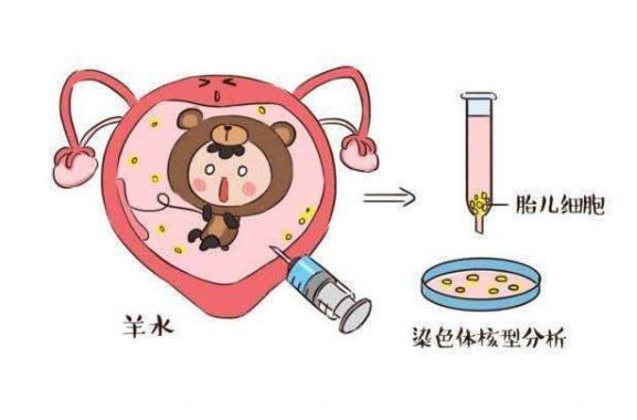 #超级宝妈#既不想“羊穿”，也不想生“唐宝宝”，孕妇该如何是好？
