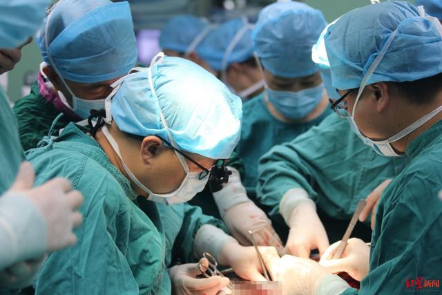 肝脏|女子患“虫癌”，肝脏被虫吃掉大半 医生“取肝修剪”救她一命