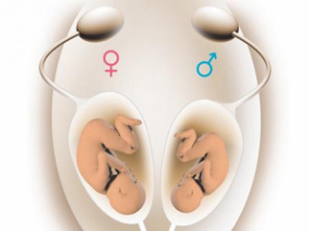 「超级宝妈」怀孕那一刻就猜测是男是女孩？胎儿性别并不重要，这个才更重要