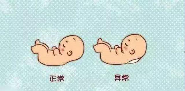 超级宝妈▲胎位不正，记错孕周，“准妈妈”错过NT检查怎么办