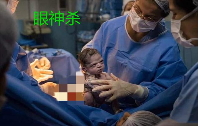 你的育儿经▲剖腹产宝宝出生后“眼神杀”太霸气，我不哭，网友：惹不起