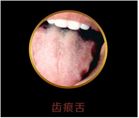 你的育儿经|看舌头，看健康！宝宝这4种常见舌象，都反映什么问题？