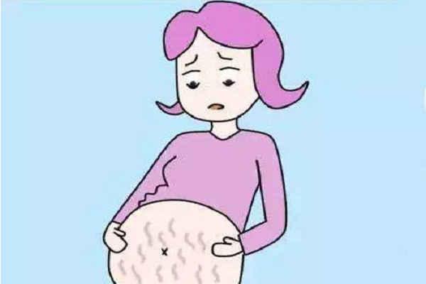 相亲相爱|用什么可去掉妊娠纹？简单实用小方法分享