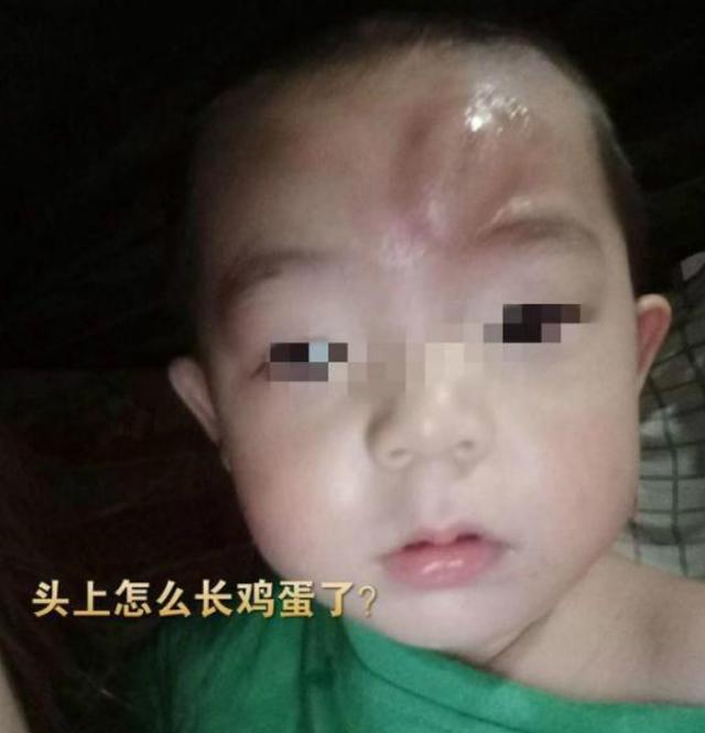 你的育儿经▲宝爸带娃翻车现场,“铁手指”给儿子脑门弹个包,宝爸:可咋交代